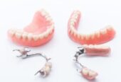 Dentures-1-e1719558605399-300×296-1